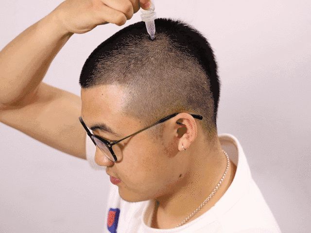 每次一小瓶，头发不再一掉一大把