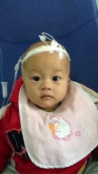 宝宝面部不对称睡觉歪着头,父母没注意,最后宝