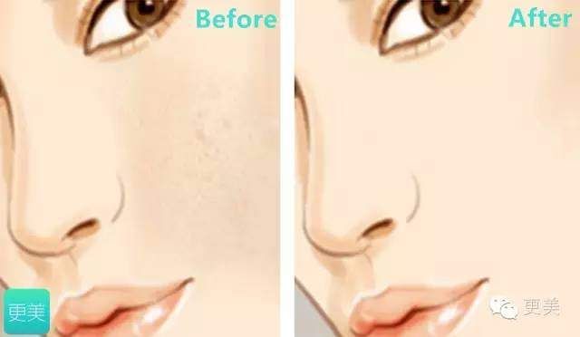 baby用CPB涂全身、林志玲打美白针，女明星为了“洗白”自己有多