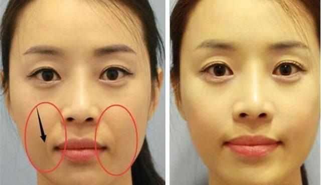 2招对抗法令纹!让女人不再显老,轻松拒绝“黄脸婆”