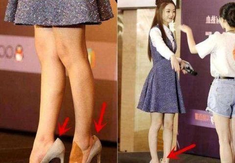 女明星穿高跟鞋的技术太强悍 佟亚丽鞋跟断了还能支撑