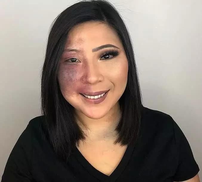 女子满脸胎记从小遭“歧视”,苦练化妆术后,先成知名“网红”!