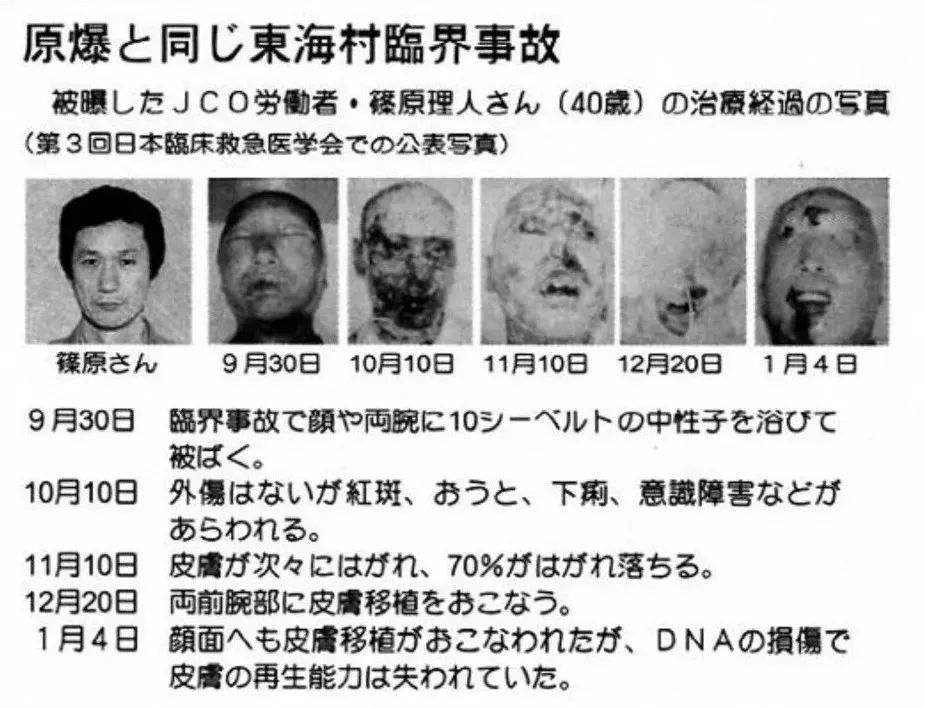 NHK纪录片 日本东海村核临界事故.2002 83