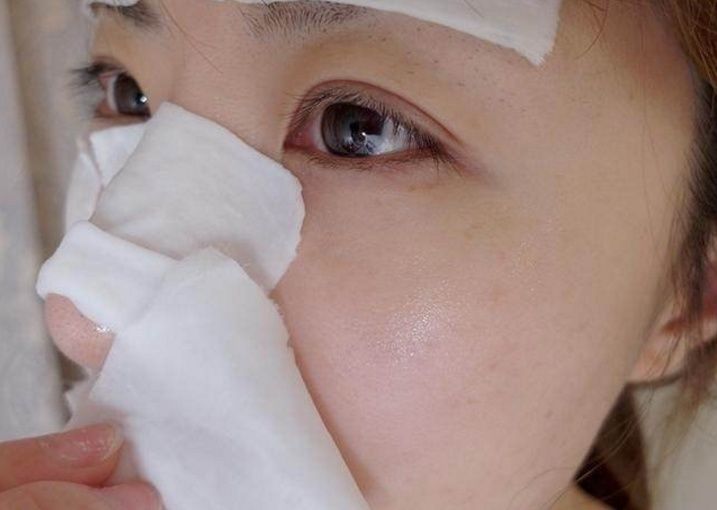 用白醋祛斑，每晚跟它敷一下，一周扫除黑色素斑点，闺蜜都吃惊了