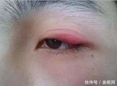 纤维条:美眼秘籍,双眼皮贴大集合,你独宠哪一种?