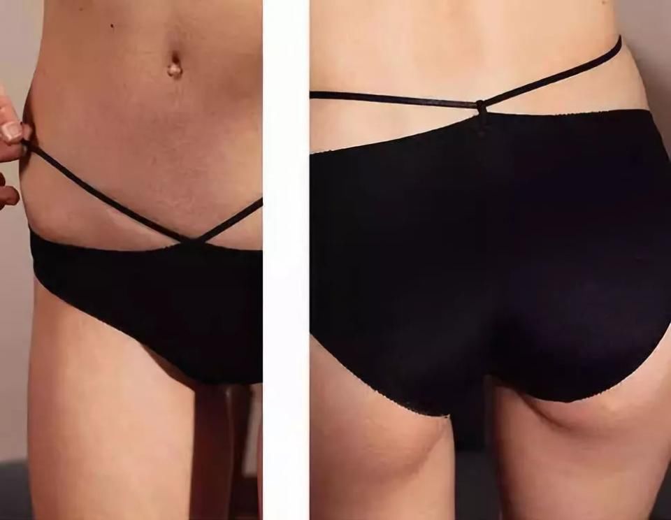 这一波，大胸输了…