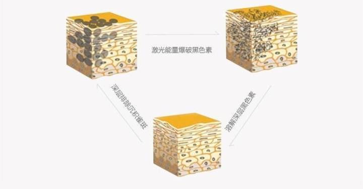 老婆斑点比较严重，拿它涂脸，10几天斑点就没了，白净的像小姑娘