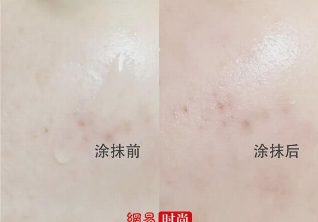  【过敏】春天不过敏！7款维稳精华超级评测