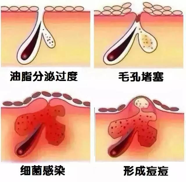 皮肤”水油不平衡“怎么办？