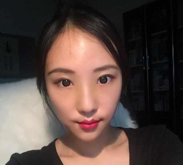  男友@小姐姐被男友带绿帽，分手后立马隆鼻，术后恢复让前任后悔莫及