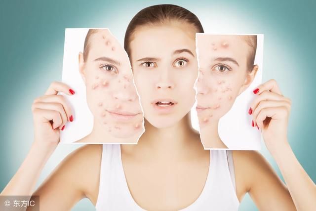 脸上螨虫特别多？只需3招，螨虫有多少灭多少，不花一毛钱