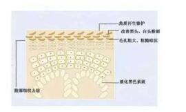 告别毛孔烦恼 HomeFacialPro新品乳糖酸原液测评