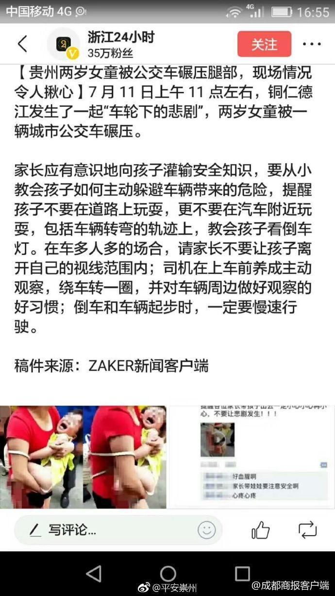 网传小孩腿部被狗咬掉血肉模糊 警方公布真相_张家口新鲜事