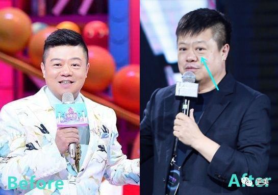 90后的郑爽关晓彤眼袋都要掉地上了，快来个医生救救她们吧!