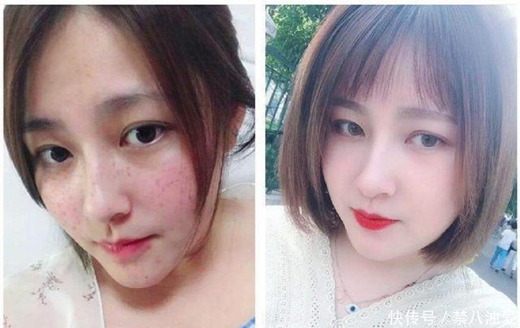  「白淡斑」车前草搭上“它”，美白淡斑有奇效，半个月，朋友的色斑脸就好了