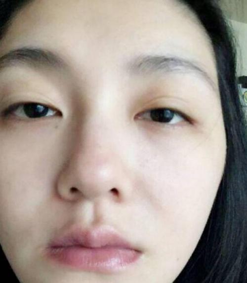 如果脸上出现这四个现象,说明脸上有螨虫,再不注意毁容指日可待