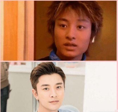 真以为男明星不整容? 他们不仅整, 而且下手还