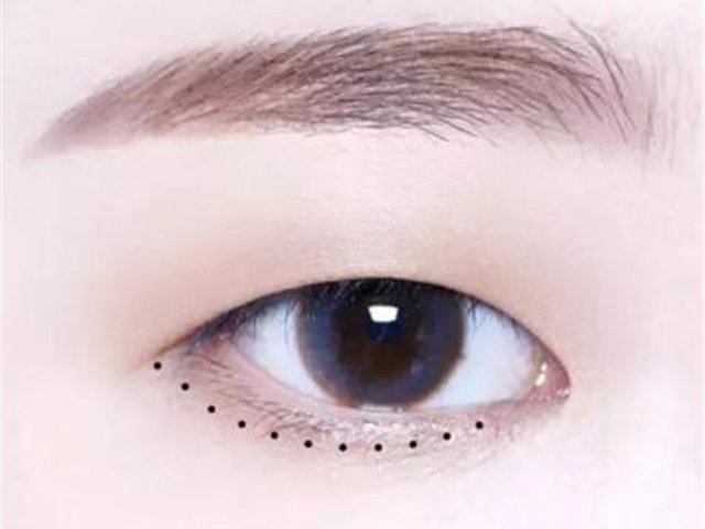 对于现在的我们来讲，单眼皮和双眼皮有什么区别呢?