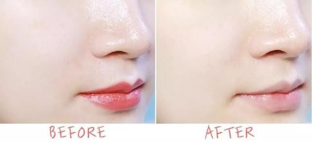 女子25年不卸妆竟长出结石!看完实在令人毛骨悚然……