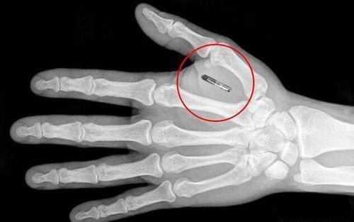 马云再次预言,手机即将被替代,不过需要给身体