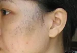 《如懿传》周迅的囧途，你若同有，一步治好!