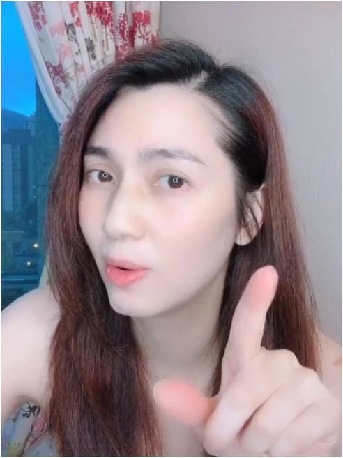 「泛红」49岁著名女星晒素颜照,露头皮疑似脱发,胳膊上泛红伤痕引担忧