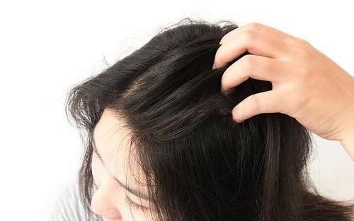  『洗发剂』恼人的头屑，油性发质，原来是这么回事！1个方法让你远离烦恼