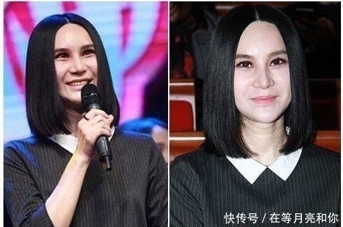  『尿酸』被玻尿酸毁了的六大女星，王心凌像老太太，而她丑到不可接受