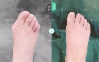 要去海边浪，除了身材还要美脚