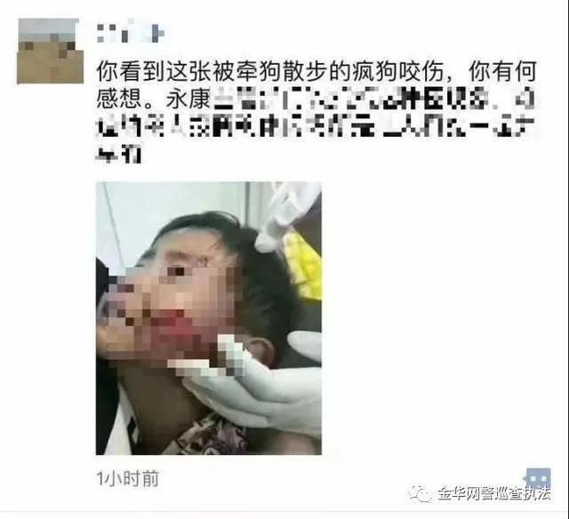 净网2018金华3岁男孩被狗咬伤半张脸？散播谣言者接受行政处罚