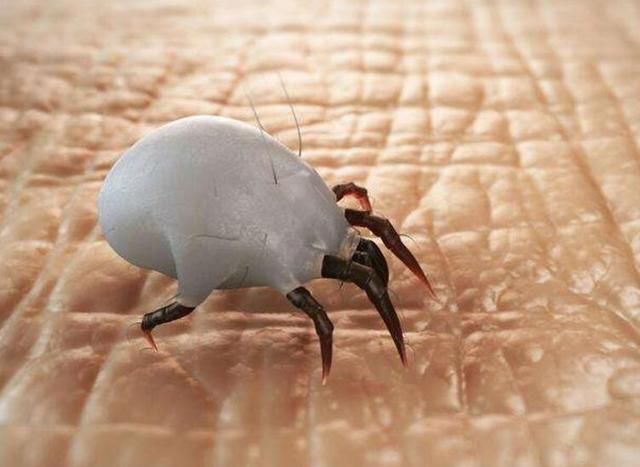 鼻子上总是挤出小米粒，因为有螨虫在钻孔，再不解决毛孔没救了