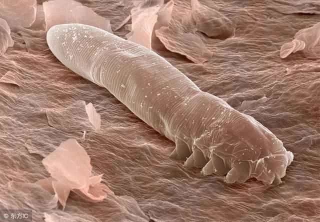 脸上螨虫过亿，除了去医院，只需一片叶子，螨虫全都死光光