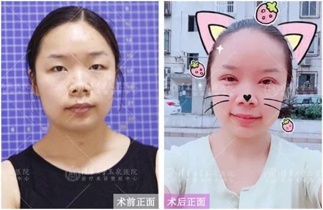  「时代」让眼睛定格美丽，告别“妆修”时代