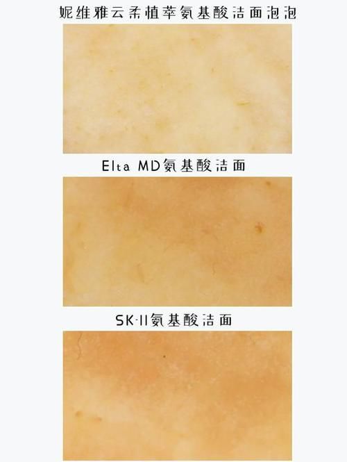  [洗面奶]换季洗脸烂脸？还不是没有找对洗面奶