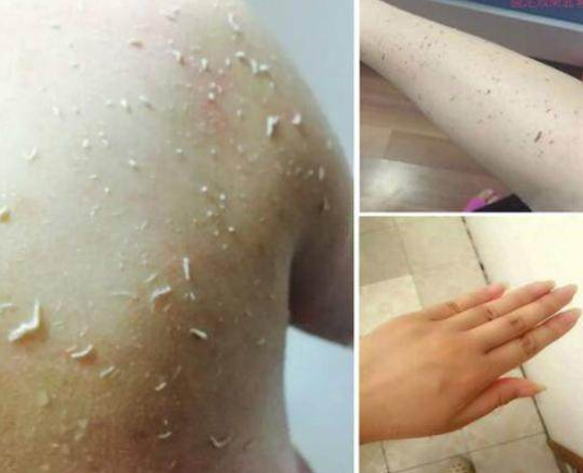 感觉脏脏的!身上搓下来的"泥"是何物?