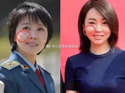  求美者来说■“苹果肌”打造全攻略！