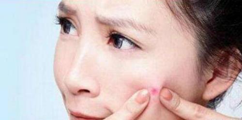 螨虫天天在脸上打洞,用这1招,脸蛋变得白白净净,开开心心等待开学