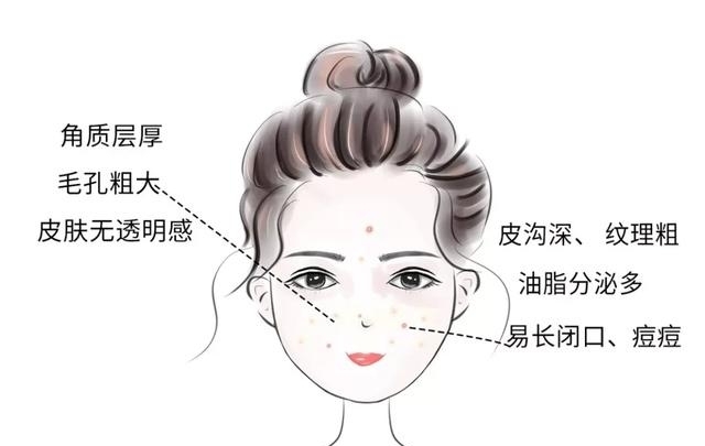 #干皮妹子#你知道自己是什么肤质吗？认准肤质，护肤才能事半功倍！