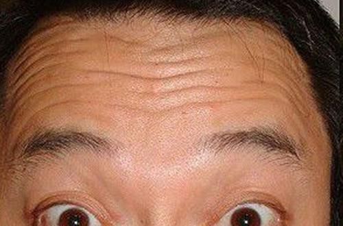  「前额」皱纹是美的克星，学会5招远离抬头纹，抗衰老别错过，你知道几种