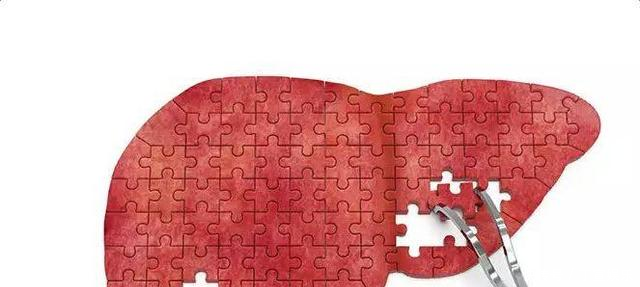 肝炎、肝硬化腹水,农村这种野草一棵就能治,简