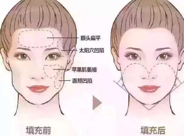 21岁的你拿什么拼过，51岁的周慧敏，48岁的莫文蔚，43岁的佘诗曼