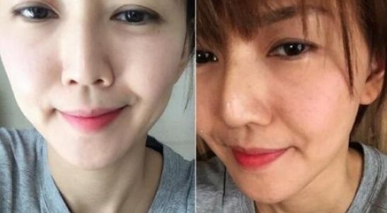 一片生姜祛斑+两滴蜂蜜美白，早晚涂3分钟，皮肤像泥鳅般嫩滑。