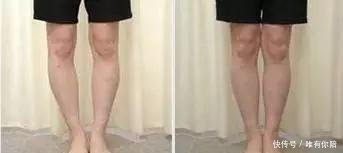 为什么日本女生大多都是O型腿？原因竟让人大开眼界！