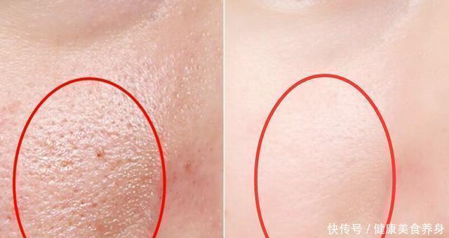  「吸收功能」越不会护肤的人，越喜欢用面膜，皮肤越差！