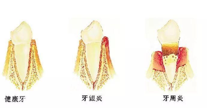  牙医■对不起，这则口红广告实在是让牙医们坐不住了！