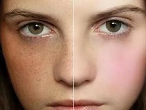 《如懿传》周迅的囧途，你若同有，一步治好!