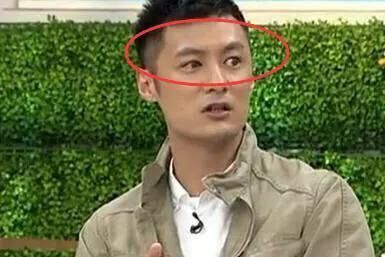 网传余文乐的另一只眼是假的，后来证实……