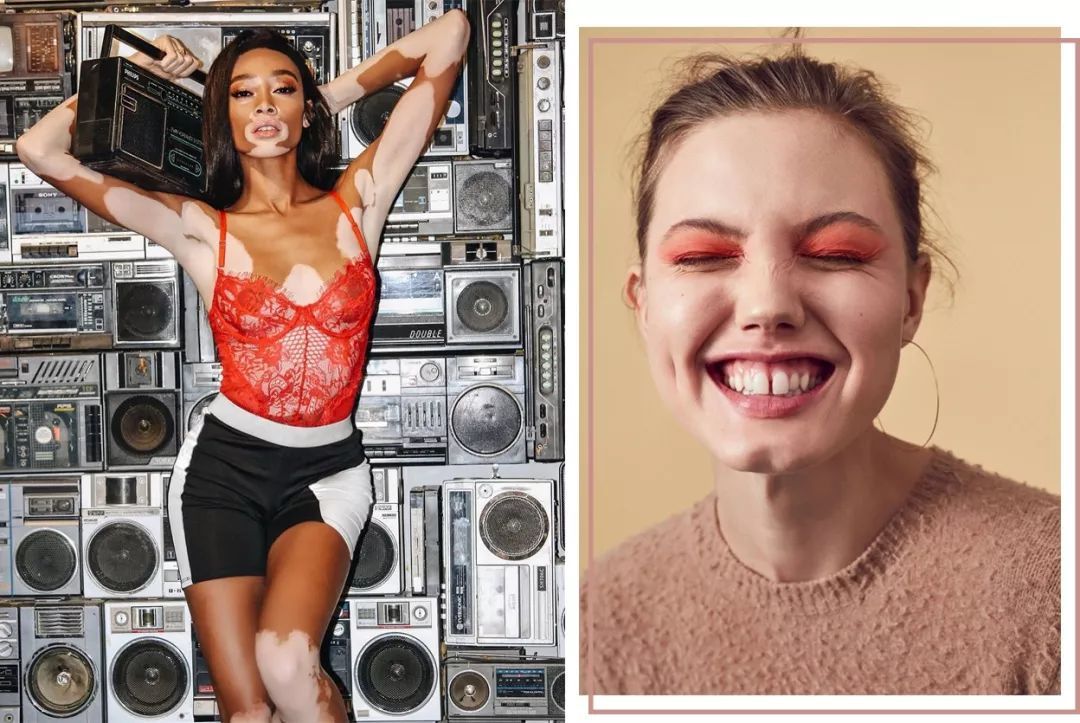 被称最"丑"模特 凭什么让大牌Dior、LV为她们翻牌?