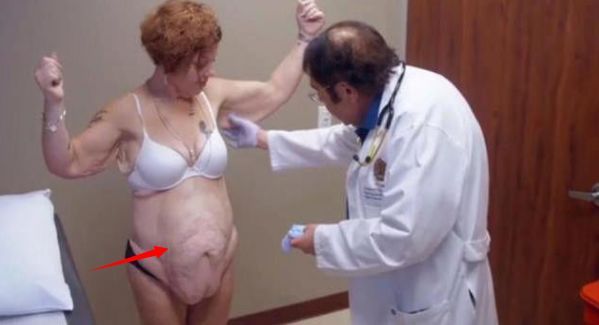 女子嫌弃自己太胖，疯狂减肥，一年后看到自己要痛哭了！