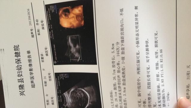 做四维彩超检查@孕期,做“四维彩超”时能看出宝宝性别或许聪明孕妈都能看明白